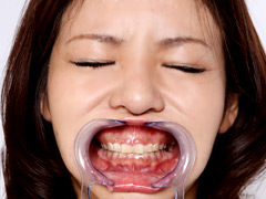 歯12
