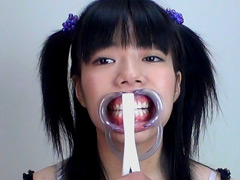 歯11