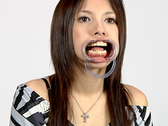 歯09