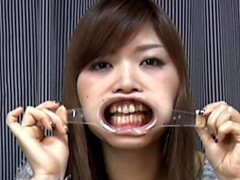 歯18