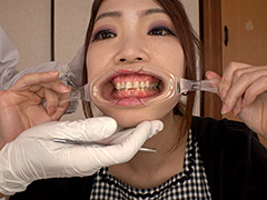 4K新口腔内観察 ☆えりあちゃん☆【全編】