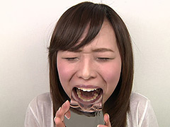 エリナちゃんの歯観察 『左上5番：涙の崩壊歯』