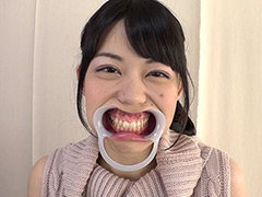 歯フェチ！銀歯観察 桜庭うれあ