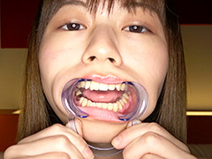 園田かのこチャンの初めての歯・口内・舌ベロ唾観察