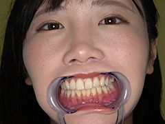 角名つむぎの超激レアな歯・口内・のどちんこ・唾観察