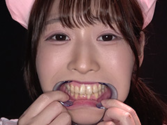 野こはるチャンの舌ベロ・歯・口内・のどちんこ観察