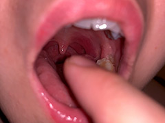 水沢つぐみの喉奥責め 腫れ気味な扁桃腺を…