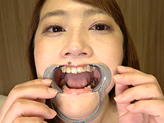 有村麻衣チャンののどちんこ・舌ベロ・歯・口内観察