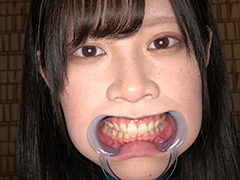エマちゃんの歯・口内・舌ベロを観察してみた