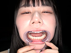 超レアな歯・口内・銀歯・のどちんこ観察！月美りょう