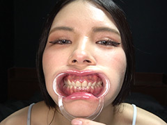 激カワ元女王様のとっても貴重な歯・口内・のどちんこ
