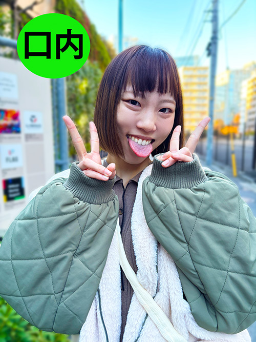 街角で声をかけて口内観察させてもらう はつみちゃん