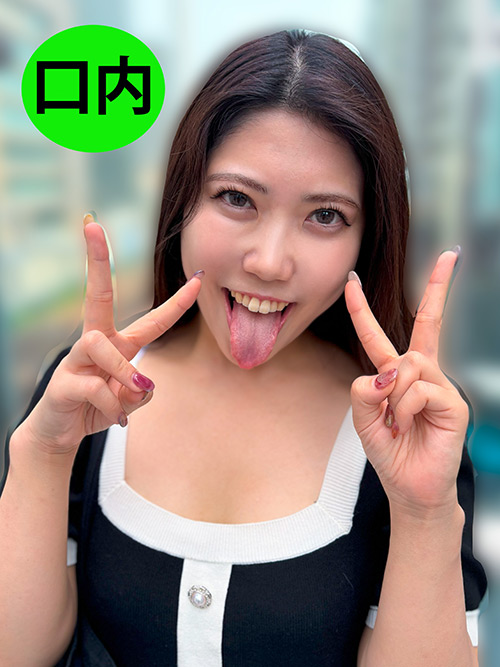 街角で声をかけて口内観察させてもらう さゆりちゃん