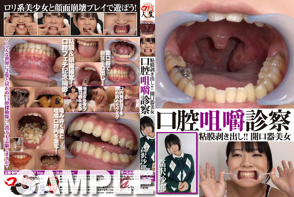 口腔咀嚼診察 粘膜剥き出し！！開口器美女 高沢沙耶