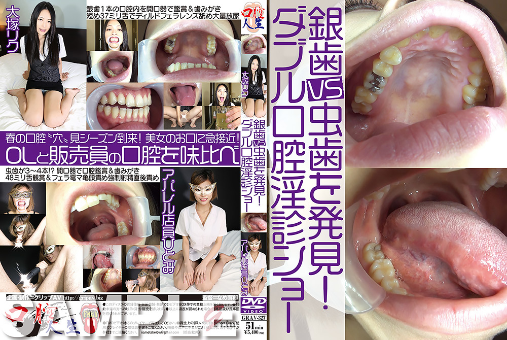 銀歯vs虫歯を発見！ダブル口腔淫診ショー