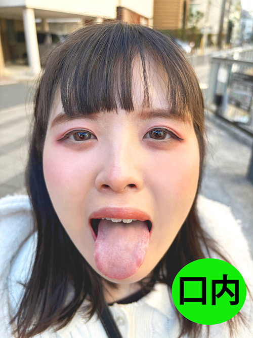 街角で声をかけて口内観察させてもらう あむちゃん