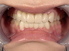 WAKA－077琥珀やや