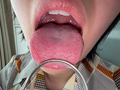 【個人撮影】加護まりの舌ブラシで「汚舌苔」採取
