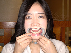初めての口内・のどちんこ観察！ことね（5）
