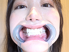 激レアの口内観察・のどちんこ観察・咀嚼！ 琥珀やや2